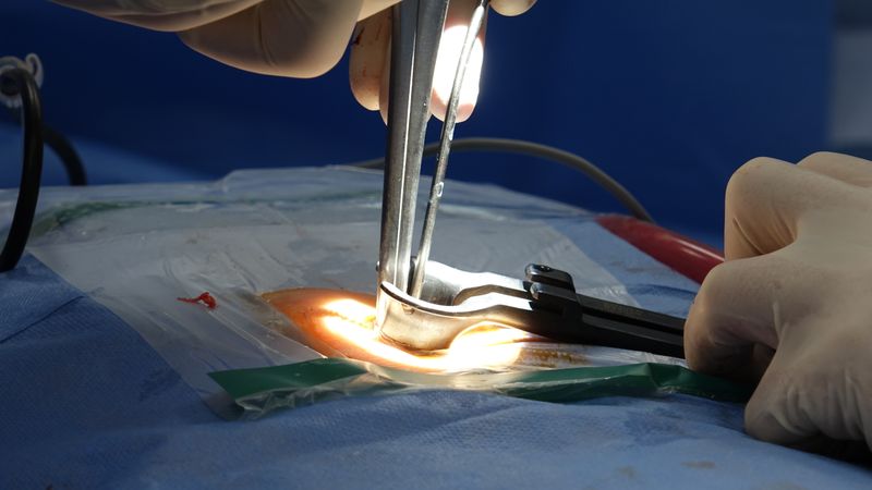 Lumbar Fusion Surgery