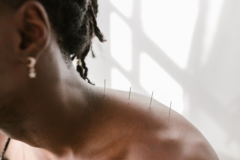 TCM Pain Management